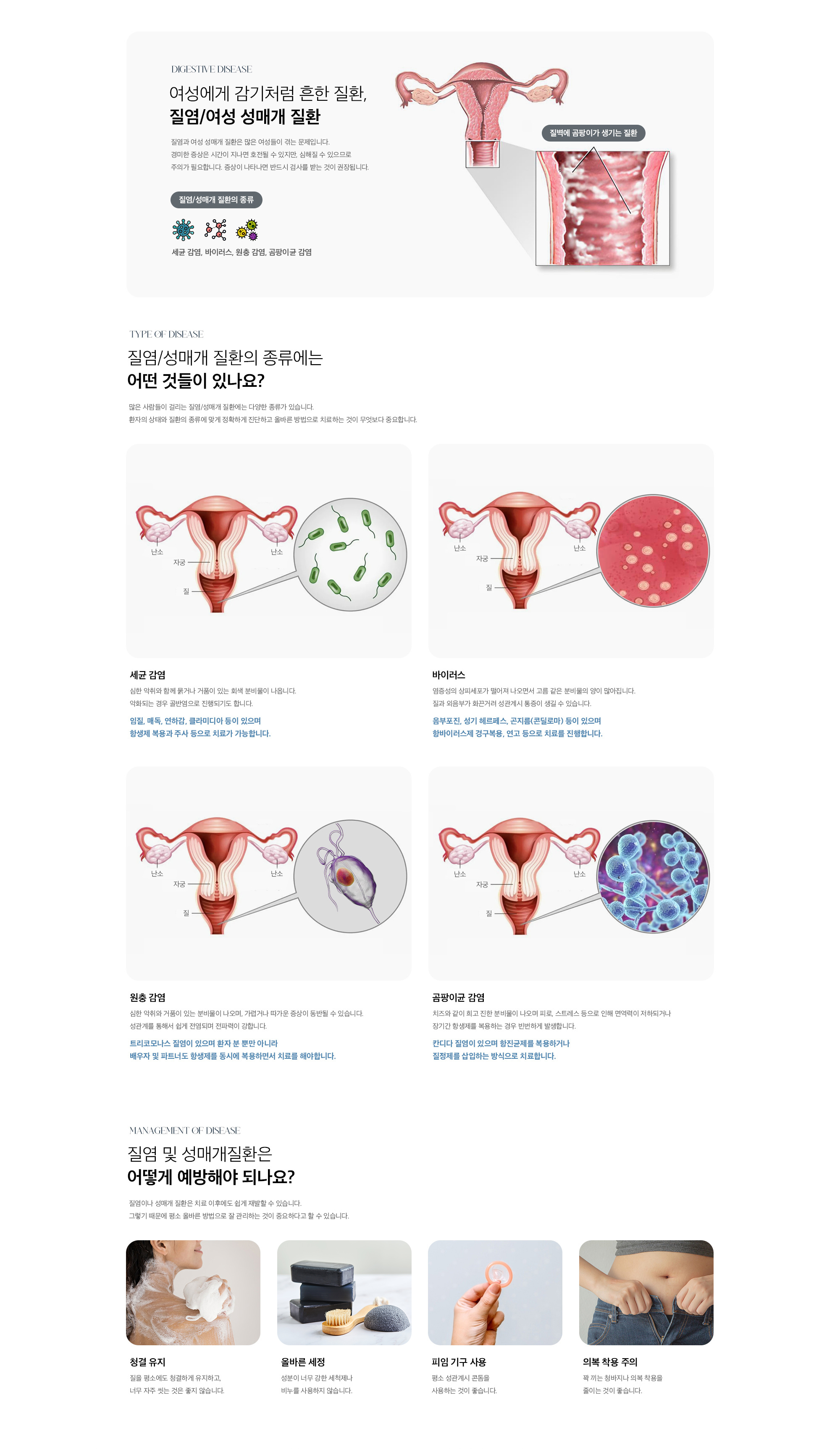 질염/여성 성매개 질환
