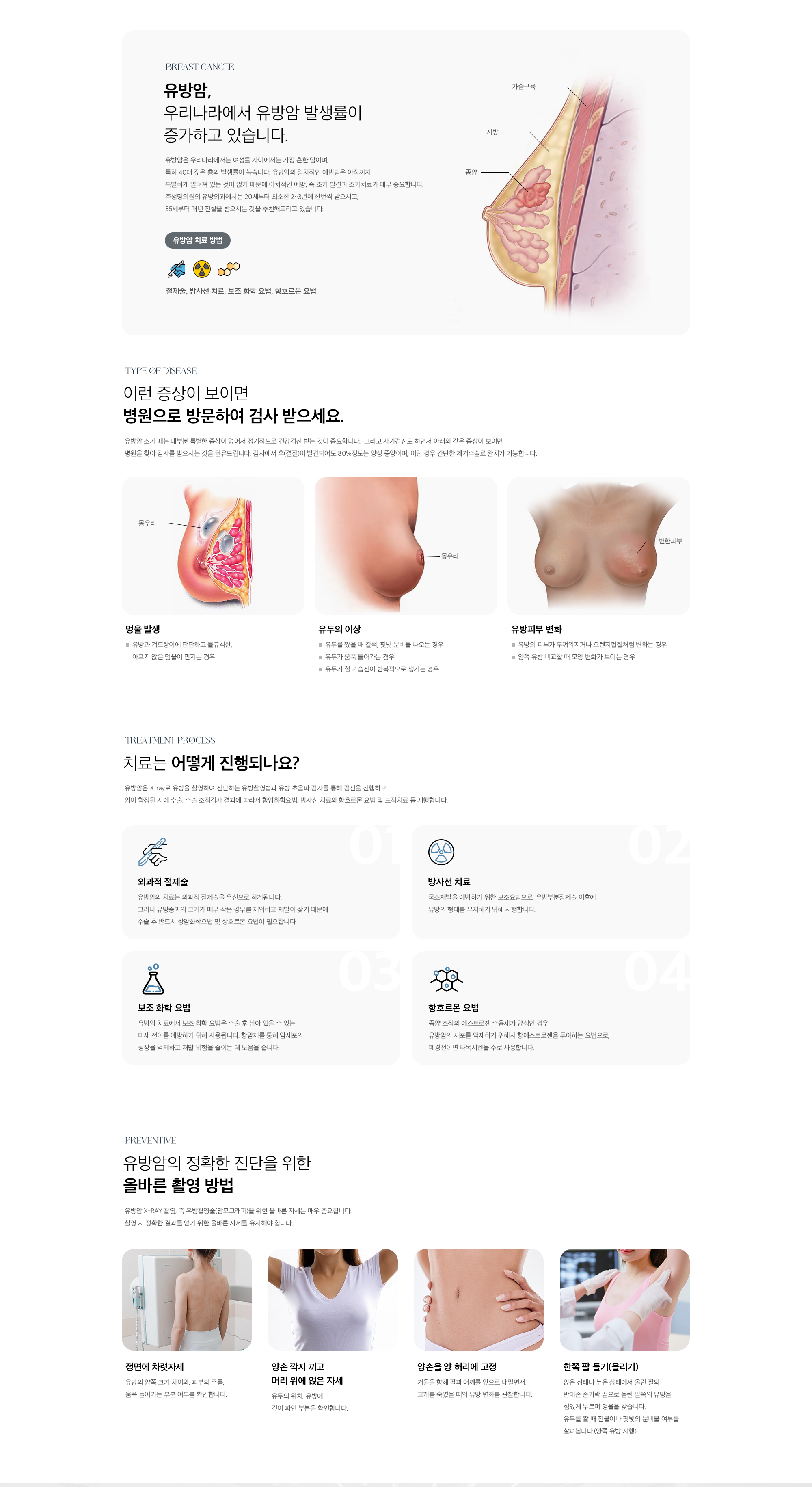 유방암